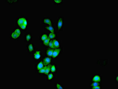 Immunofluorescent analysis of PC-3 cells using SEPSECS Antibody at dilution of 1:100 and Alexa Fluor 488-congugated AffiniPure Goat Anti-Rabbit IgG(H+L)Rabbit anti-Human SEPSECS Polyclonal Antibody