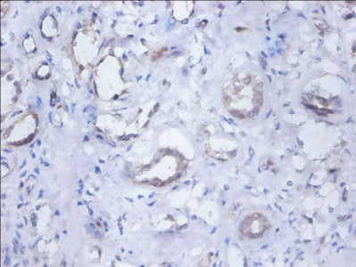 Immunohistochemistry of paraffin-embedded human kidney tissue using SEPSECS Antibody at dilution of 1:100Rabbit anti-Human SEPSECS Polyclonal Antibody