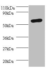 Western blot  | All lanes: SEPSECS antibody at 2µg/ml + 293T whole cell lysate  | Secondary  | Goat polyclonal to rabbit IgG at 1/10000 dilution  | Predicted band size: 56, 6 kDa  | Observed band size: 56 kDaRabbit anti-Human SEPSECS Polyclonal Antibody