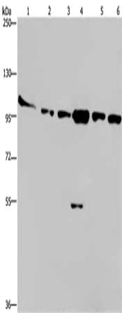 Gel: 6%SDS-PAGE, Lysate: 40 μg, Lane 1-6: Human testis tissue, K562 cells, A549 cells, Raji cells, NIH/3T3 cells, Hela cells, Primary antibody: PRKD3 Antibody(PRKD3 Antibody) at dilution 1/200, Secondary antibody: Goat anti rabbit IgG at 1/8000 dilution, Exposure time: 10 minutesRabbit anti-Human PRKD3 Polyclonal Antibody