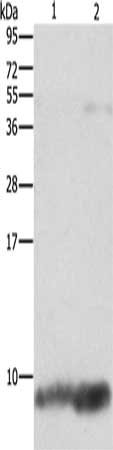 Gel: 12%SDS-PAGE, Lysate: 40 μg, Lane 1-2: Mouse brain tissue, Mouse heart tissue, Primary antibody: FXYD1 Antibody(FXYD1 Antibody) at dilution 1/1290, Secondary antibody: Goat anti rabbit IgG at 1/8000 dilution, Exposure time: 1 secondRabbit anti-Human FXYD1 Polyclonal Antibody