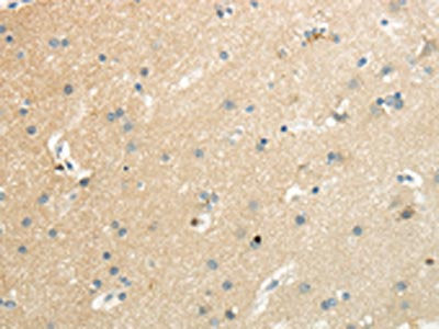 The image on the left is immunohistochemistry of paraffin-embedded Human brain tissue using the antibody Antibody) at dilution 1/35, on the right is treated with synthetic peptide. (Original magnification: ×200)Rabbit anti-Human SLC7A11 Polyclonal Antibody