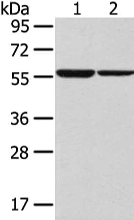 Gel: 8%SDS-PAGE, Lysate: 40 μg, Lane 1-2: K562 and hepg2 cell, Primary antibody: SLC7A11 Antibody(SLC7A11 Antibody) at dilution 1/300 dilution, Secondary antibody: Goat anti rabbit IgG at 1/8000 dilution, Exposure time: 30 secondsRabbit anti-Human SLC7A11 Polyclonal Antibody