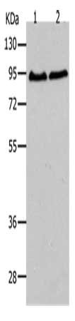 Gel: 10%SDS-PAGE, Lysate: 40 μg, Lane 1-2: Hela cells, 293T cells, Primary antibody: AKAP8 Antibody(AKAP8 Antibody) at dilution 1/250, Secondary antibody: Goat anti rabbit IgG at 1/8000 dilution, Exposure time: 2 minutesRabbit anti-Human AKAP8 Polyclonal Antibody
