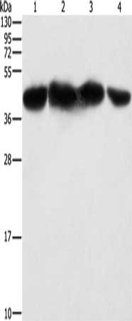 Gel: 10%SDS-PAGE, Lysate: 40 μg, Lane 1-4: HepG2 cells, 293T cells, hela cells, NIH/3T3 cells, Primary antibody: PGK2 Antibody(PGK2 Antibody) at dilution 1/600, Secondary antibody: Goat anti rabbit IgG at 1/8000 dilution, Exposure time: 5 secondsRabbit anti-Human PGK2 Polyclonal Antibody
