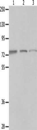 Gel: 10%SDS-PAGE, Lysate: 40 μg, Lane 1-3: A549 cells, Jurkat cells, 293T cells, Primary antibody: MAGED1 Antibody(MAGED1 Antibody) at dilution 1/1200, Secondary antibody: Goat anti rabbit IgG at 1/8000 dilution, Exposure time: 3 minutes
