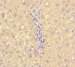 Immunohistochemistry of paraffin-embedded human liver tissue using the antibody at dilution of 1:100Rabbit anti-Human A2M Polyclonal Antibody