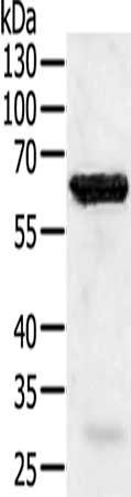 Gel: 10%SDS-PAGE, Lysate: 40 μg, Lane: Jurkat cells, Primary antibody: TRAF5 Antibody(TRAF5 Antibody) at dilution 1/450, Secondary antibody: Goat anti rabbit IgG at 1/8000 dilution, Exposure time: 3 secondsRabbit anti-Human TRAF5 Polyclonal Antibody