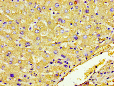 IHC image of HP Antibody diluted at 1:600 and staining in paraffin-embedded human liver tissue performed on a Leica BondTM system. After dewaxing and hydration, antigen retrieval was mediated by high pressure in a citrate buffer (pH 6.0). Section was blocked with 10% normal goat serum 30min at RT. Then primary antibody (1% BSA) was incubated at 4°C overnight. The primary is detected by a biotinylated secondary antibody and visualized using an HRP conjugated ABC system.Rabbit anti-Human HP Polyclonal Antibody
