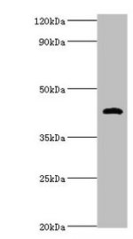 Western blot  | All lanes: HP antibody at 2µg/ml + Mouse stomach tissue  | Secondary  | Goat polyclonal to rabbit IgG at 1/10000 dilution  | Predicted band size: 46, 39 kDa  | Observed band size: 46 kDaRabbit anti-Human HP Polyclonal Antibody