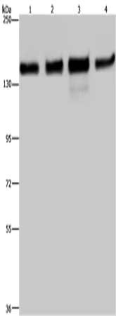 Gel: 6%SDS-PAGE, Lysate: 40 μg, Lane 1-4: 293T cells, Hela cells, A172 cells, A549 cells, Primary antibody: GOLGA2 Antibody(GOLGA2 Antibody) at dilution 1/600, Secondary antibody: Goat anti rabbit IgG at 1/8000 dilution, Exposure time: 10 secondsRabbit anti-Human GOLGA2 Polyclonal Antibody