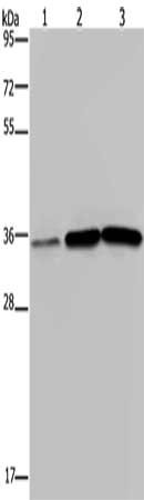 Gel: 10%SDS-PAGE, Lysate: 40 μg, Lane 1-3: Human testis tissue, A549 cells, PC3 cells, Primary antibody: MAGEA3 Antibody(MAGEA3 Antibody) at dilution 1/400, Secondary antibody: Goat anti rabbit IgG at 1/8000 dilution, Exposure time: 2 minutes