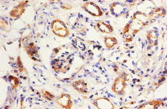 Immunohistochemistry of paraffin-embedded human kidney tissue using KNG1 Antibody at dilution of 1:50