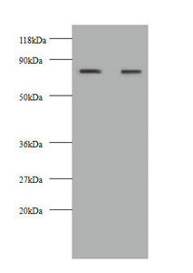Western blot  | All lanes: KNG1 antibody at 2µg/ml  | Lane 1: HepG2 whole cell lysate  | Lane 2: 293T whole cell lysate  | Secondary  | Goat polyclonal to rabbit IgG at 1/10000 dilution  | Predicted band size: 72, 48, 44 kDa  | Observed band size: 72 kDa