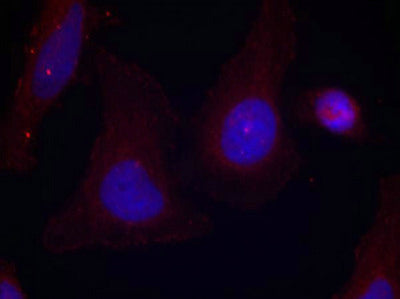 Immunofluorescence staining of methanol-fixed Hela cells using Pyk2(Phospho-Tyr402) Antibody.Rabbit anti-Human PTK2B Polyclonal Antibody