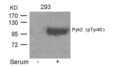 Western blot analysis of extracts from 293 cells untreated or treated with Serum using Pyk2(Phospho-Tyr402) Antibody.Rabbit anti-Human PTK2B Polyclonal Antibody