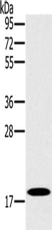 Gel: 10%SDS-PAGE, Lysate: 40 μg, Lane: Human fetal brain tissue, Primary antibody: STMN1 Antibody(STMN1 Antibody) at dilution 1/200, Secondary antibody: Goat anti rabbit IgG at 1/8000 dilution, Exposure time: 10 secondsRabbit anti-Human STMN1 Polyclonal Antibody
