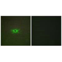 Immunofluorescence analysis of A549 cells, using PRKAG2 antibody.Rabbit anti-Human PRKAG2 Polyclonal Antibody