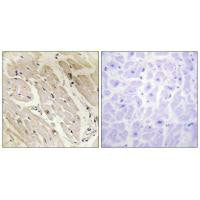 Immunohistochemistry analysis of paraffin-embedded human heart tissue, using PRKAG2 antibody.Rabbit anti-Human PRKAG2 Polyclonal Antibody