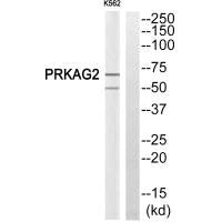 Western blot analysis of extracts from K562 cells, using PRKAG2 antiobdy.Rabbit anti-Human PRKAG2 Polyclonal Antibody