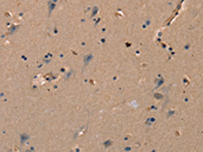 The image on the left is immunohistochemistry of paraffin-embedded Human brain  tissue using KLK14 Antibody(KLK14 Antibody) at dilution 1/40, on the right is treated with synthetic peptide. (Original magnification: ×200)
