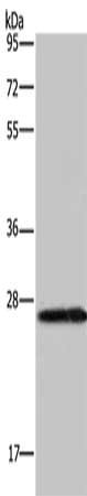 Gel: 10%SDS-PAGE, Lysate: 40 μg, Lane: PC3 cells, Primary antibody: KLK14 Antibody(KLK14 Antibody) at dilution 1/200, Secondary antibody: Goat anti rabbit IgG at 1/8000 dilution, Exposure time: 2 minutes