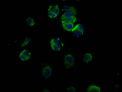 Immunofluorescence staining of MCF-7 cells with TFR2 Antibody at 1:66, counter-stained with DAPI. The cells were fixed in 4% formaldehyde, permeabilized using 0.2% Triton X-100 and blocked in 10% normal Goat Serum. The cells were then incubated with the antibody overnight at 4°C. The secondary antibody was Alexa Fluor 488-congugated AffiniPure Goat Anti-Rabbit IgG(H+L).Rabbit anti-Human TFR2 Polyclonal Antibody