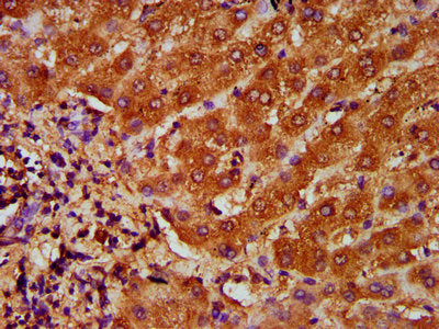 IHC image of TFR2 Antibody diluted at 1:200 and staining in paraffin-embedded human liver tissue performed on a Leica BondTM system. After dewaxing and hydration, antigen retrieval was mediated by high pressure in a citrate buffer (pH 6.0). Section was blocked with 10% normal goat serum 30min at RT. Then primary antibody (1% BSA) was incubated at 4°C overnight. The primary is detected by a biotinylated secondary antibody and visualized using an HRP conjugated SP system.Rabbit anti-Human TFR2 Polyclonal Antibody