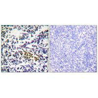 Immunohistochemistry analysis of paraffin-embedded human tonsil tissue using NYREN18 antibody.Rabbit anti-Human NUB1 Polyclonal Antibody
