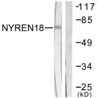 Western blot analysis of extracts from COS7 cells, using NYREN18 antibody.Rabbit anti-Human NUB1 Polyclonal Antibody