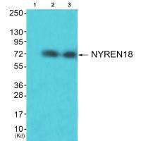 Western blot analysis of extracts from HuvEc cells (Lane 2) and JK cells (Lane 3), using NYREN18 antiobdy. The lane on the left is treated with synthesized peptide.Rabbit anti-Human NUB1 Polyclonal Antibody