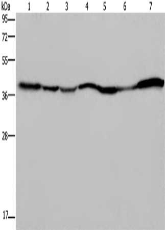 Gel: 10%SDS-PAGE, Lysate: 40 μg, Lane 1-7: 293T cells, Hela cells, Human fetal liver tissue, mouse spleen tissue, Mouse heart tissue, human fetal brain tissue, hepatocellular carcinoma tissue, Primary antibody: GOT2 Antibody(GOT2 Antibody) at dilution 1/400, Secondary antibody: Goat anti rabbit IgG at 1/8000 dilution, Exposure time: 10 secondsRabbit anti-Human GOT2 Polyclonal Antibody