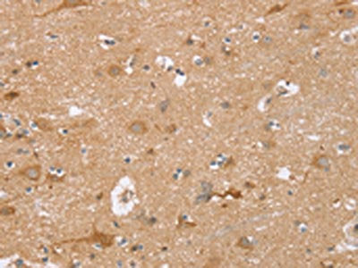The image on the left is immunohistochemistry of paraffin-embedded Human brain  tissue using TRIM34 Antibody(TRIM34 Antibody) at dilution 1/30, on the right is treated with synthetic peptide. (Original magnification: ×200)Rabbit anti-Human TRIM34 Polyclonal Antibody