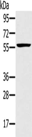 Gel: 8%SDS-PAGE, Lysate: 40 μg, Lane: Jurkat cells, Primary antibody: TRIM34 Antibody(TRIM34 Antibody) at dilution 1/250, Secondary antibody: Goat anti rabbit IgG at 1/8000 dilution, Exposure time: 40 secondsRabbit anti-Human TRIM34 Polyclonal Antibody