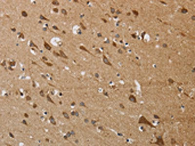 The image on the left is immunohistochemistry of paraffin-embedded Human brain  tissue using KCNMB4 Antibody(KCNMB4 Antibody) at dilution 1/30, on the right is treated with synthetic peptide. (Original magnification: ×200)