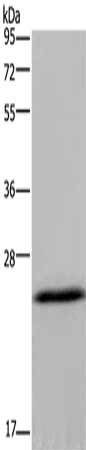 Gel: 10%SDS-PAGE, Lysate: 40 μg, Lane: Mouse brain tissue, Primary antibody: KCNMB4 Antibody(KCNMB4 Antibody) at dilution 1/500, Secondary antibody: Goat anti rabbit IgG at 1/8000 dilution, Exposure time: 20 seconds