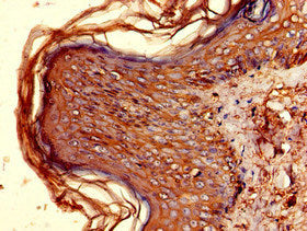 Immunohistochemistry of paraffin-embedded human skin tissue using the antibody at dilution of 1:100Rabbit anti-Human HLA-DQB1 Polyclonal Antibody