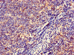 Immunohistochemistry of paraffin-embedded human lymph node tissue using HLA-DQB1 Antibody at dilution of 1:100Rabbit anti-Human HLA-DQB1 Polyclonal Antibody