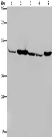 Gel: 8%SDS-PAGE, Lysate: 40 μg, Lane 1-5: Human fetal muscle tissue, Jurkat cells, 293T cells, Hela cells, mouse liver tissue, Primary antibody: IDH2 Antibody(IDH2 Antibody) at dilution 1/600, Secondary antibody: Goat anti rabbit IgG at 1/8000 dilution, Exposure time: 10 secondsRabbit anti-Human IDH2 Polyclonal Antibody