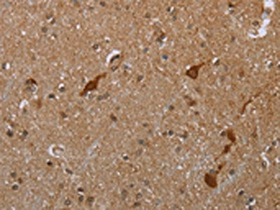 The image is immunohistochemistry of paraffin-embedded human brain tissue using the antibody Antibody) at dilution 1/20. (Original magnification: ×200)