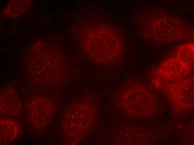 Immunofluorescence staining of methanol-fixed MCF7 cells using PTEN (phospho-Ser370) antibody.Rabbit anti-Human PTEN Polyclonal Antibody
