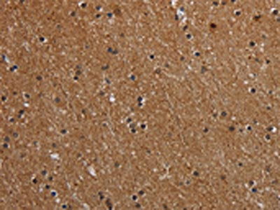 The image on the left is immunohistochemistry of paraffin-embedded Human brain  tissue using MT-ND1 Antibody(MT-ND1 Antibody) at dilution 1/50, on the right is treated with synthetic peptide. (Original magnification: ×200)Rabbit anti-Human MT-ND1 Polyclonal Antibody
