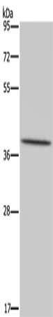Gel: 8%SDS-PAGE, Lysate: 40 μg, Lane: Hela cells, Primary antibody: MT-ND1 Antibody(MT-ND1 Antibody) at dilution 1/450, Secondary antibody: Goat anti rabbit IgG at 1/8000 dilution, Exposure time: 3 minutesRabbit anti-Human MT-ND1 Polyclonal Antibody