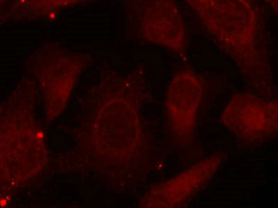 Immunofluorescence staining of methanol-fixed Hela cells using Merlin(Phospho-Ser518) Antibody.Rabbit anti-Human NF2 Polyclonal Antibody