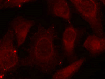 Immunofluorescence staining of methanol-fixed Hela cells using Merlin(Phospho-Ser518) Antibody.Rabbit anti-Human NF2 Polyclonal Antibody