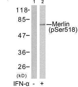 Western blot analysis of extracts from HUVEC cells untreated(lane 1) or treated with IFN-a(lane 2) using Merlin(Phospho-Ser518) Antibody.Rabbit anti-Human NF2 Polyclonal Antibody