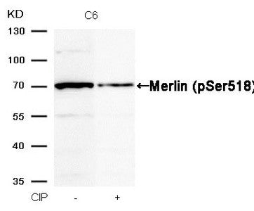 Western blot analysis of extracts from C6 cells, treated with calf intestinal phosphatase (CIP), using Merlin (Phospho-Ser518) Antibody.Rabbit anti-Human NF2 Polyclonal Antibody