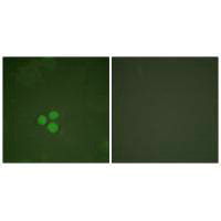 Immunofluorescence analysis of HeLa cells, treated with Forskolin (40nM, 30mins), using DP-1 antibody.Rabbit anti-Human TFDP1 Polyclonal Antibody