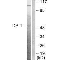 Western blot analysis of extracts from HeLa cells, using DP-1 antibody.Rabbit anti-Human TFDP1 Polyclonal Antibody
