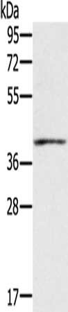Gel: 8%SDS-PAGE, Lysate: 60 μg, Lane: Mouse muscle tissue, Primary antibody: IFNGR2 Antibody(IFNGR2 Antibody) at dilution 1/200, Secondary antibody: Goat anti rabbit IgG at 1/8000 dilution, Exposure time: 1 minuteRabbit anti-Human IFNGR2 Polyclonal Antibody